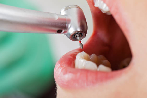 Best Urgent Care for Lost Fillings or Crowns in Jan Phyl Village, FL